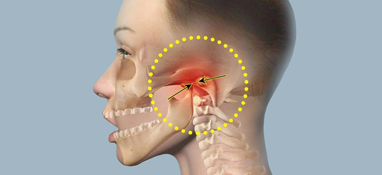 Заклинило челюсть – причины, что делать